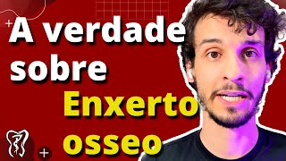 Enxerto Ósseo Parte 2 -  Osso para quem quer implantes Dentários