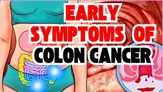 Warning: Early Signals of Colon Cancer.