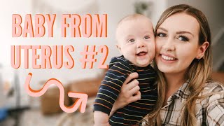 I HAD A BABY IN EACH UTERUS! | Double Uterus Pregnancy (Uterus Didelphys)