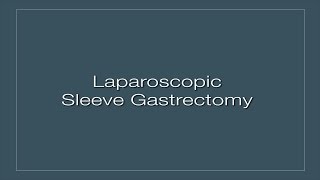 Laparoscopic Sleeve Gastrectomy