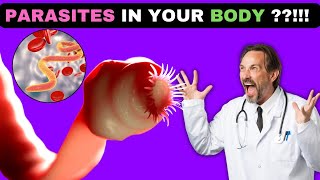 Parasites in your body?! OMG ! Don't ignore these early warning signs.