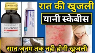 Scabies (यानी रात की खुजली सात जनम तक नही होगी बस ये वीडियो देख लो | Scabies treatment