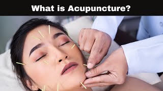 What is Acupuncture?