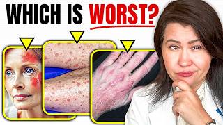 The 3 WORST Autoimmune Diseases!