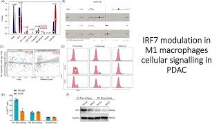 IRF7 Gene in M1 type Macrophage modulates pancreatic cancer cellular changes in signaling #Code: 638