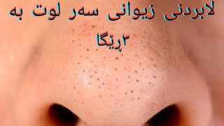 چۆنیتی لابردنی زیوانی سەر لوت (زیپکەی ڕەشی سەر لوت)