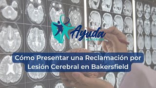 Cómo Presentar una Reclamación por Lesión Cerebral en Bakersfield