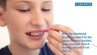 Instructional Video Ortho