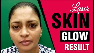 Best SKIN GLOW Treatment Testimonial: Real Results & Transformation! | Sakhiya Skin Clinic Review