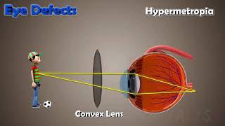 Human Eye_ CBSE Class9