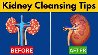 Why These Top 10 Foods DETOX and CLEANSE Kidneys Reverse Damage