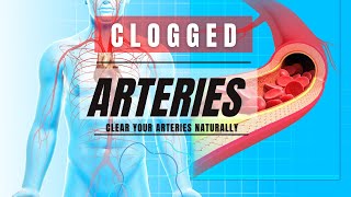 CLEAR Your Arteries NATURALLY [ A Heart-Friendly Guide]