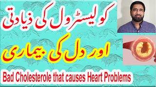 High Cholesterol and Heart Health | Bad Cholesterol | Which cholesterol causes heart attack in Urdu