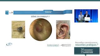 8. Spécificités d'appareillage en cas de perforation tympanique