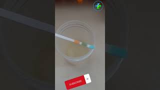 Urine protein test | urine dipstick method | albumin in urine | protien in urine  #medicallaboratory