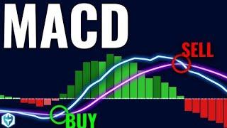 MACD Indicator Trading Setup Explained | Share Market for Beginners