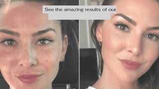 Dermal Fillers Chicago