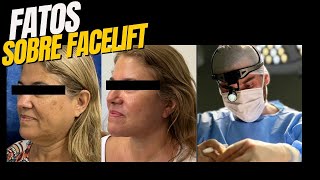 FACELIFT: 5 FATOS ESSENCIAIS QUE VOCÊ PRECISA SABER!