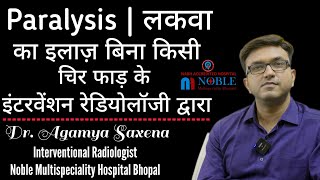 लकवा, stroke, Paralysis, ट्यूमर के इलाज में क्रांति है इंटरवेंशन रेडि‍योलॉजी | Dr Agamya Saxena