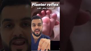 Planter reflex 😁 #دكتور #explore #react #baby