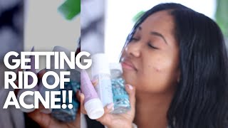 HOW I GET RID OF ACNE | ACNE IN YOUR 30s