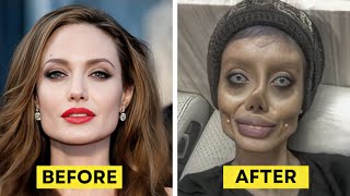 20 Times Plastic Surgery Gone Wrong