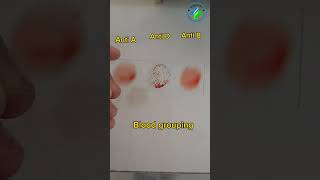 Blood grouping | ABO blood grouping | ABO system | Rh system | blood bank | hematology