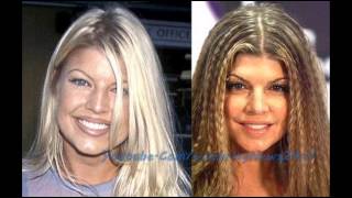 Fergie Plastic Surgery Before and After HD