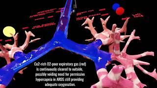 Mechanical Ventilation 2.0 vs Contemporary Mechanical Ventilation (Release 2.0)