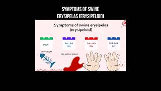 Symptoms of swine erysipelas (erysipeloid) #streptococcus #skininfection #erysipelas #infection