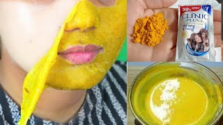 सबका बाप है ये facial तुरंत सारा मेल उतार कालापन, झाइयाँ, झुर्रियां सब जड़ से ख़त्म।💝Facial hacks