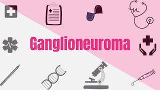 Adrenal Gland Tumors (Ganglioneuroma)