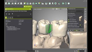 DWOS - Create Split Bridge