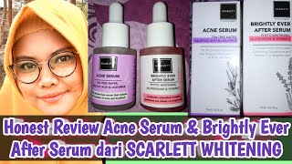 Honest Review Acne Serum & Brightky Ever After Serum dari Scarlett Whitening