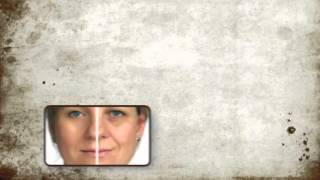 Elite Plastic Surgery Reviews - Scottsdale az, Plastic surgery