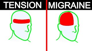 5 Types of Headaches and the Best Ways to Get Rid of Them 🤯 (Efficient Headache Relief Methods)