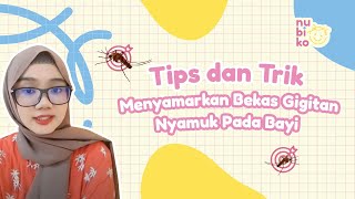 Tips dan Trik Menyamarkan Bekas Gigitan Nyamuk Pada Bayi