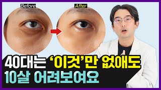 청담동 클리닉 원장이 말하는 눈밑꺼짐 없애는 법