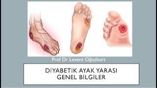 Diyabetik ayak yarası 1