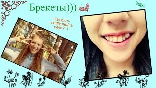 ❀БРЕКЕТЫ))) Как не стесняться?♥Плюсы и Минусы♥Впечатления/Маша Жукова