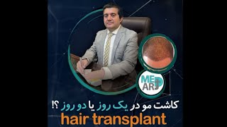 کاشت مو در یک روز یا دو روز؟!