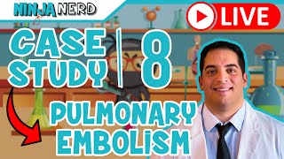 Case Study #8: Pulmonary Embolism