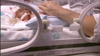 Challenges of Premature Birth