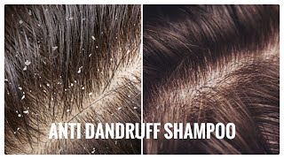 Dandruff: Hair Care Routine To Treat Dandruff | REVIEW Lemon + Ginger Shampoo & Conditioner