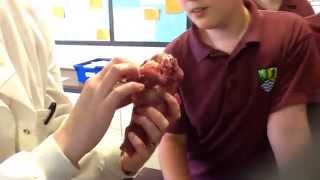 Sheep Heart & Lung Dissection - Wyedean Science Club