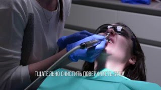 Имплантация эмали InnoDent в клинике