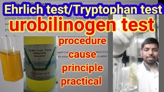 Urobilinogen test ll Ehrlich test ll Tryptophan test in urine practical