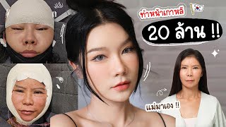 รีวิวทำหน้าสวยครบ1เดือน ผ่าตัดดึงหน้า | ทำเอนโดไทน์ยกคิ้วกับแม่ที่เกาหลี หน้านี้ใช้เงินเท่าไหร่