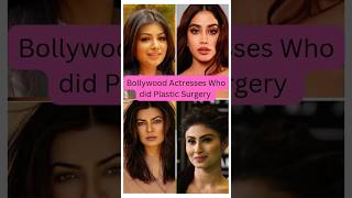 Bollywood Actresses Who Did Plastic Surgery | बॉलीवुड एक्ट्रेसेस जिन्होंने की प्लास्टिक सर्जरी