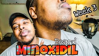 Growing Beard With Minoxidil Week 4